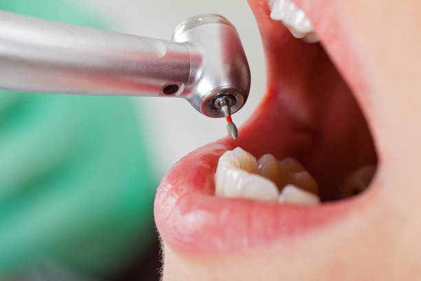 Best Cracked Tooth Emergency Dentist  in Dundee, NY